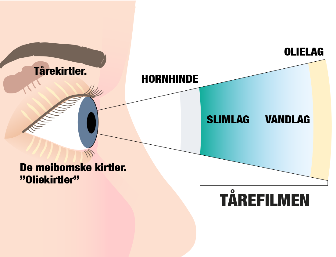 t&oslash;rre &oslash;jne
